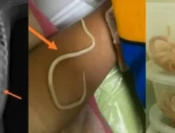 Usus Balita di Jember Penuh Cacing, Akibatnya Tak Bisa BAB 4 Usus Balita di Jember Penuh Cacing, Akibatnya Tak Bisa BAB